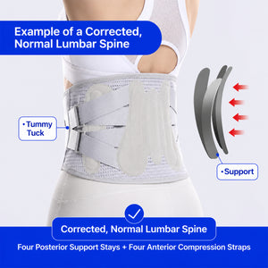 UOUBEO H6 Lumbar Support Belt – 4 Steel Stays & 360° Support